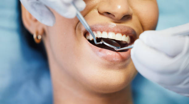 Best Chipped Tooth Repair Near Me  in Black Diamond, FL