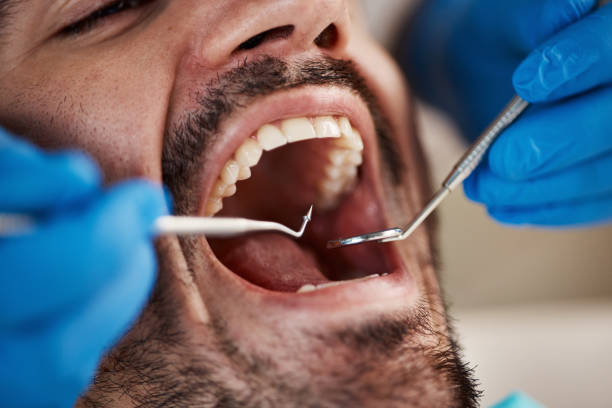 Best Tooth Pain Emergency Relief  in Black Diamond, FL